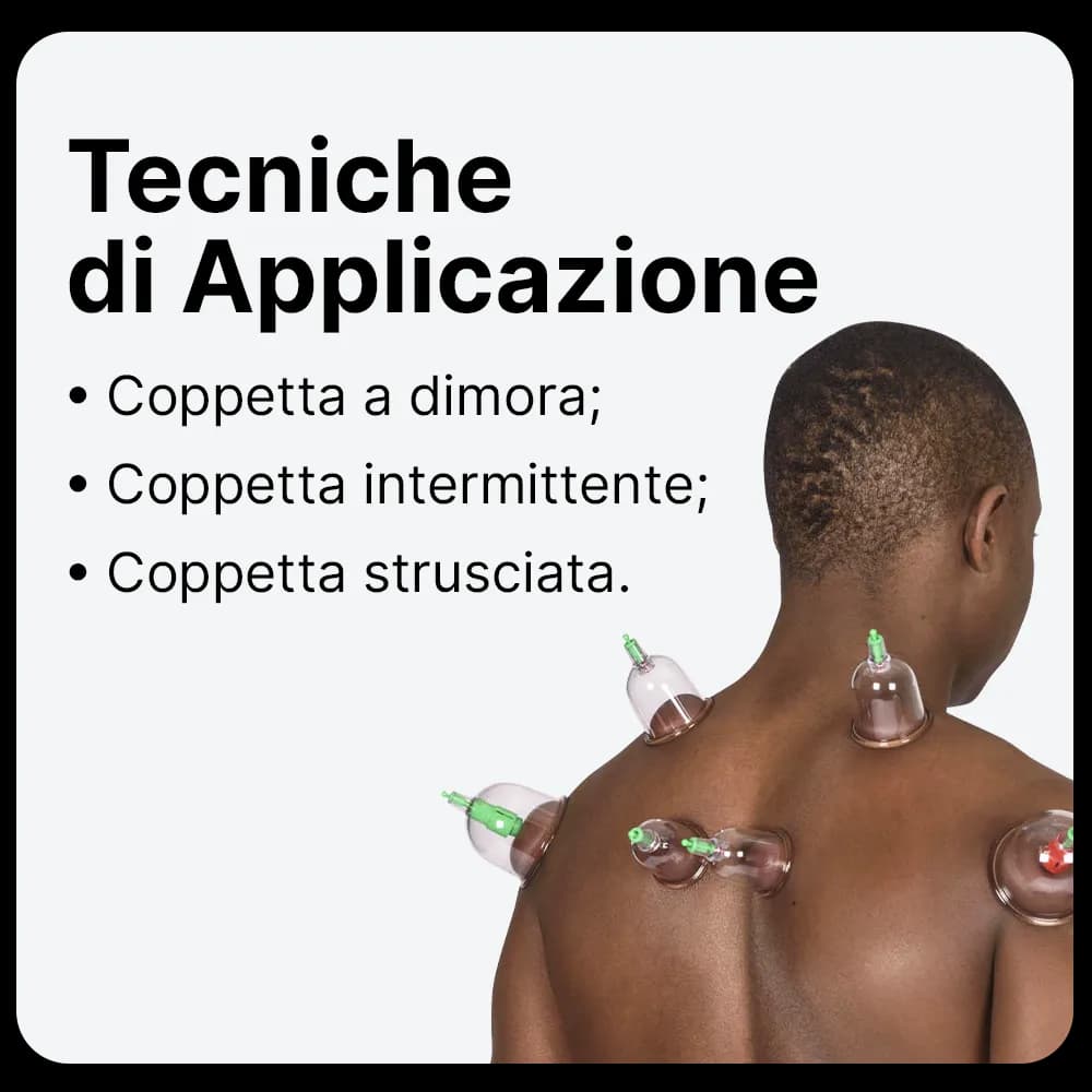 Applicazioni Coppette