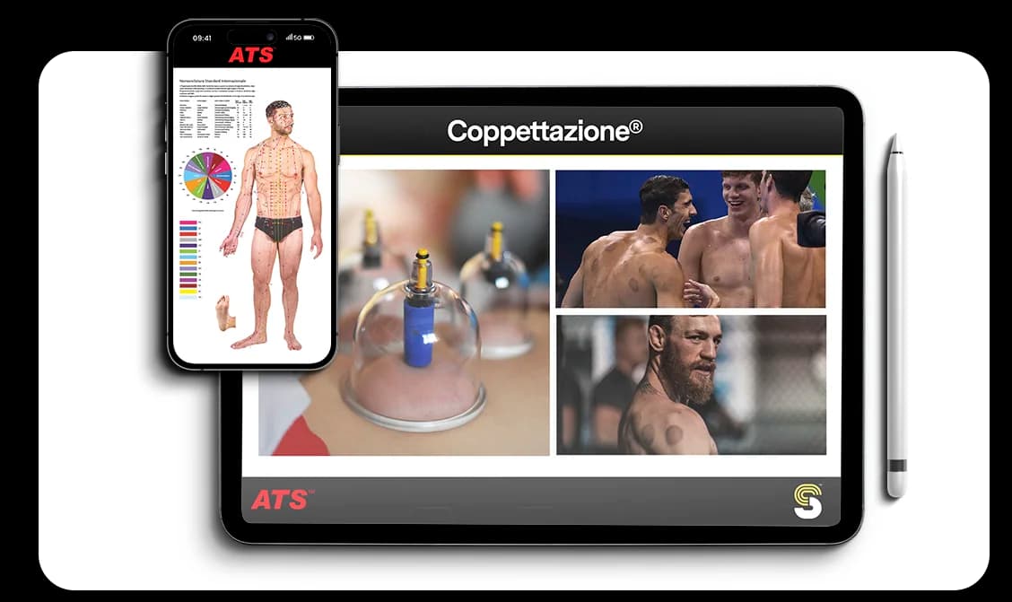 Coppettazione per lo sportivo