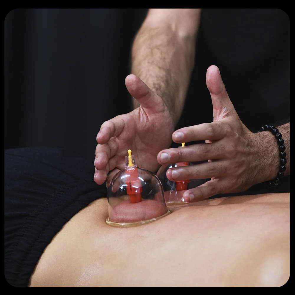 Cupping therapy