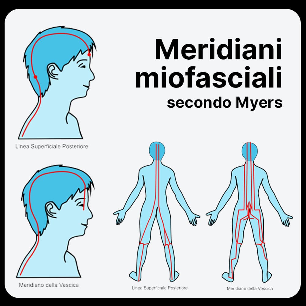 Meridiani-miofasciali-video-corso-Coppettazione-Istituto