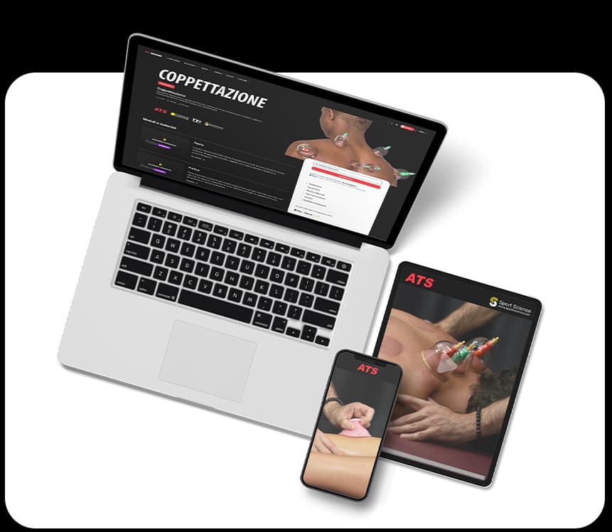 Coppettazione tecniche applicazione