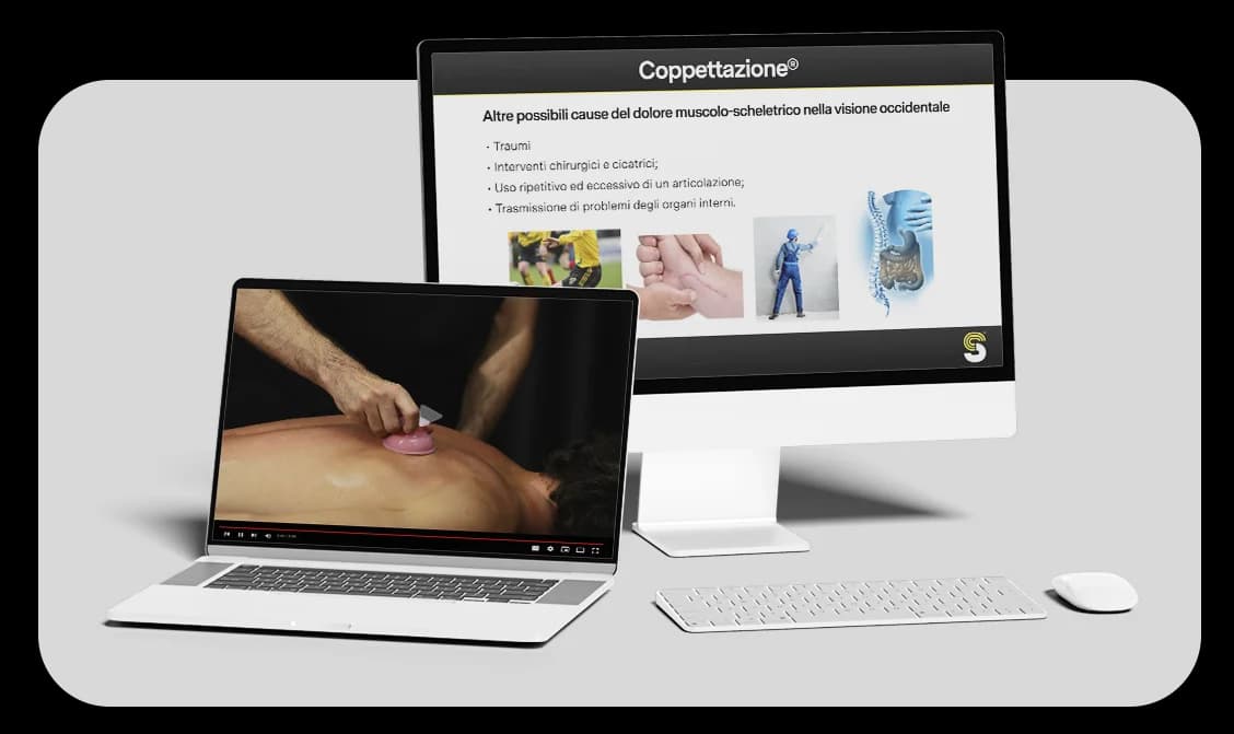 Cupping therapy video corso
