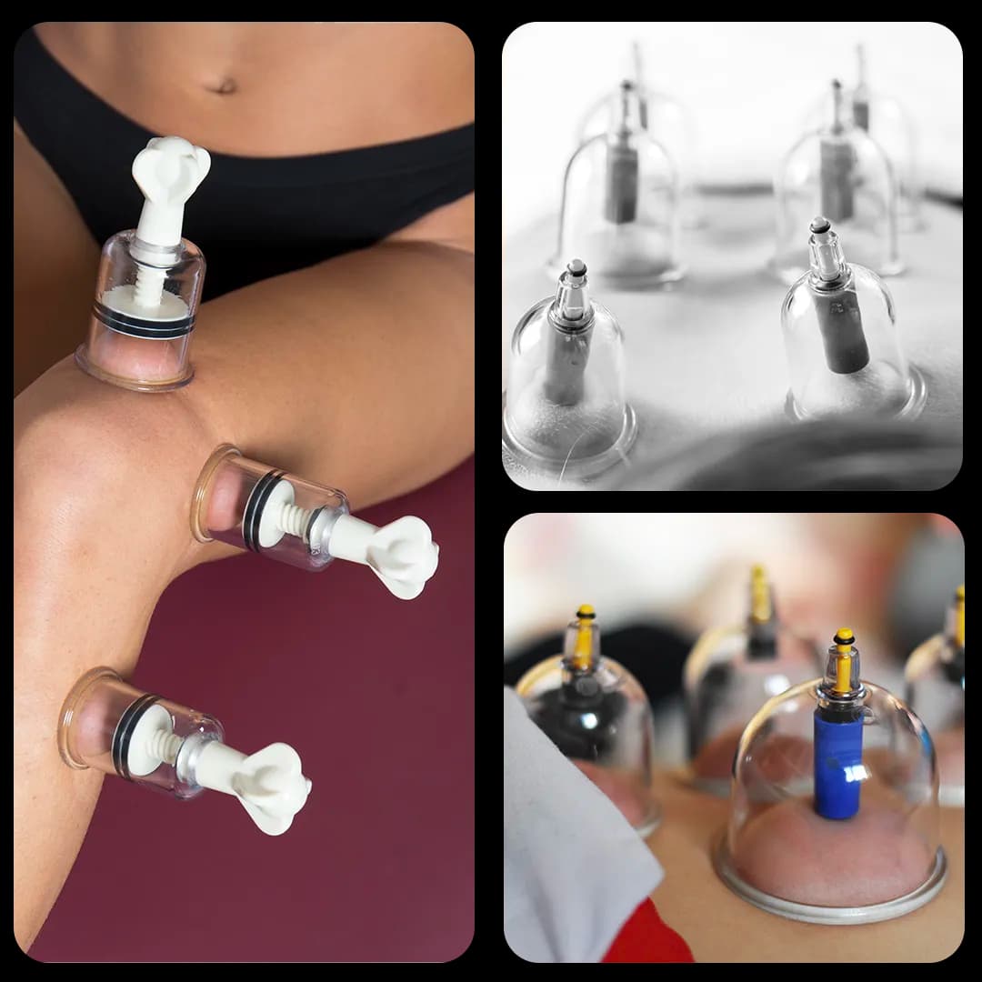 Filosofia Cupping therapy