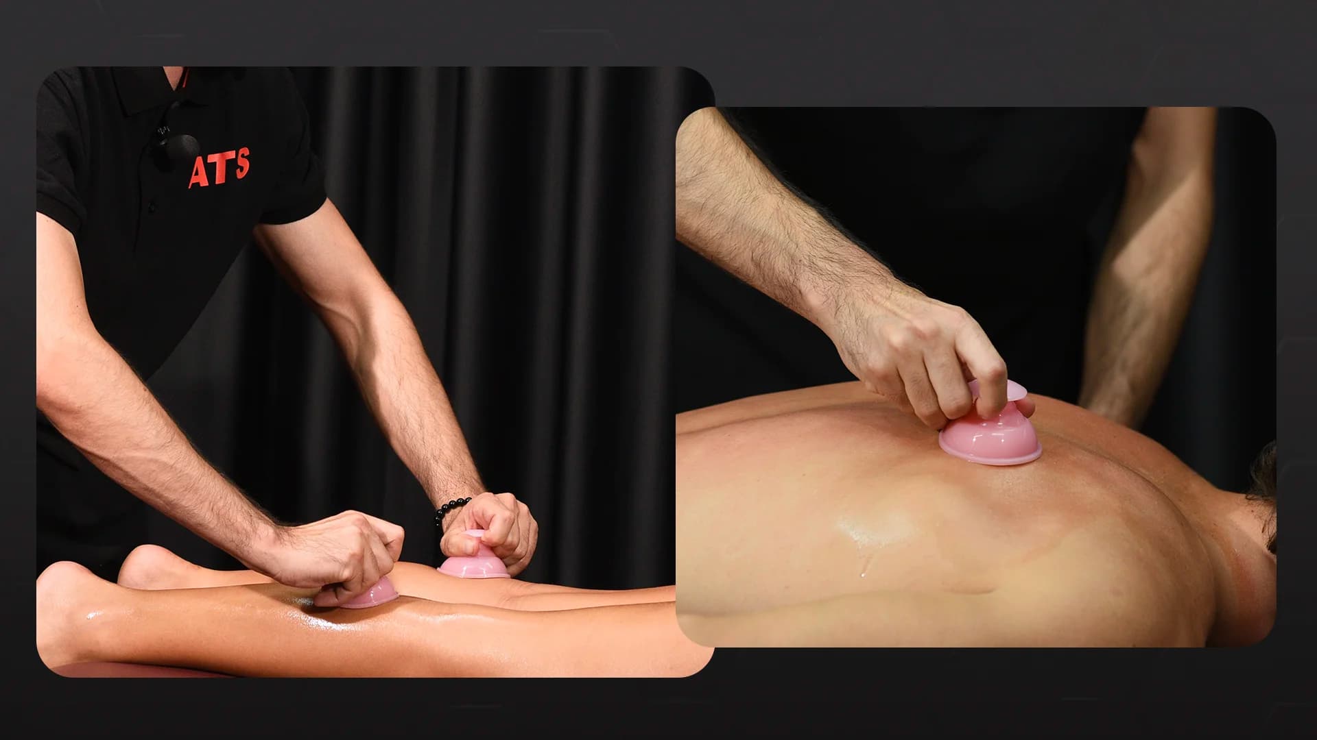 Massaggio con le Coppette: tecnica strusciata